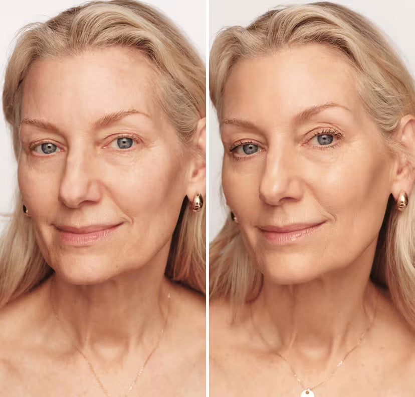 Adaptation parfaite de la teinte